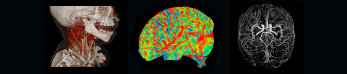 Toshiba Medical Research Institute USA, Inc. (TMRU) is involved in most aspects of medical imaging