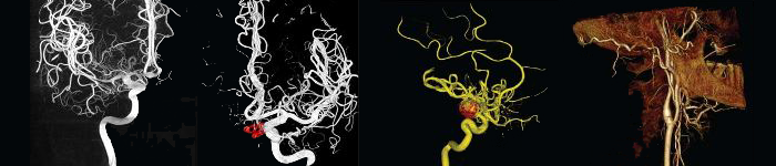 Toshiba Medical Research Institute USA medical image scans of various sections of the human body