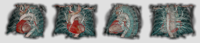 Toshiba Medical Research Institute USA medical scan images of various parts of the human body