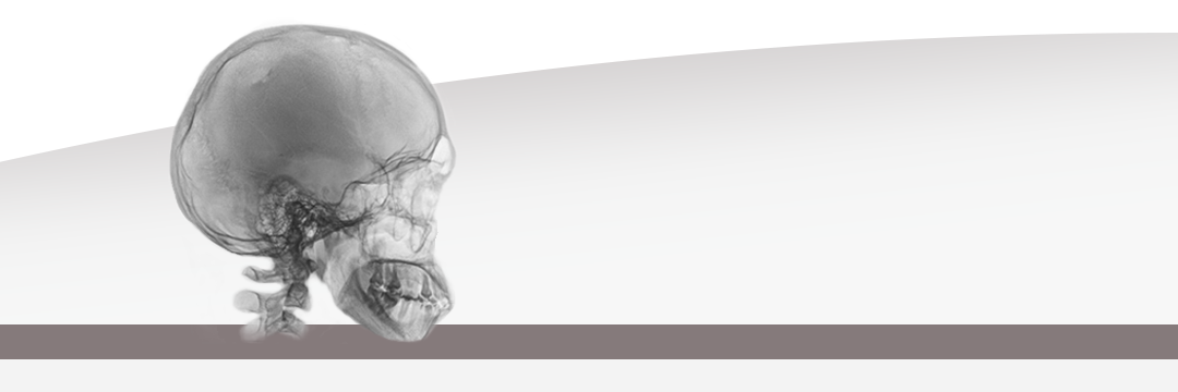 Toshiba Medical Research Institute USA scanned image of human skull